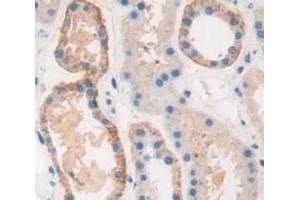 IHC-P analysis of Human Tissue, with DAB staining.