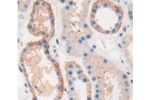 IHC-P analysis of Human Tissue, with DAB staining. (PRSS23 anticorps  (AA 20-383))