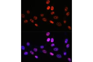 Immunofluorescence analysis of NIH-3T3 cells using P Rabbit mAb (ABIN7269445) at dilution of 1:100 (40x lens). (PABPN1 anticorps)