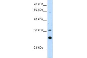 Western Blotting (WB) image for anti-Ribosomal Protein, Large, P0 (RPLP0) antibody (ABIN2462059) (RPLP0 anticorps)