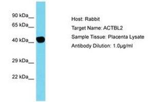 Image no. 1 for anti-Actin, beta-Like 2 (ACTBL2) (C-Term) antibody (ABIN6750797) (ACTBL2 anticorps  (C-Term))