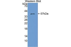Western blot analysis of the recombinant protein. (KRT15 anticorps  (AA 94-402))