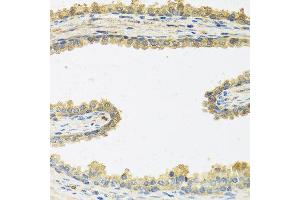 Immunohistochemistry of paraffin-embedded human prostate using CRHBP antibody at dilution of 1:100 (40x lens). (CRHBP anticorps)