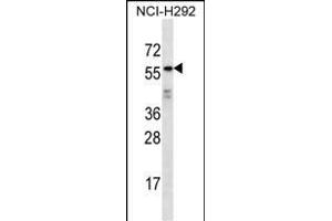 ODF2L Antibody (C-term) (ABIN656938 and ABIN2846129) western blot analysis in NCI- cell line lysates (35 μg/lane). (ODF2L anticorps  (C-Term))