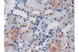 Detection of LRRC32 in Rat Kidney Tissue using Polyclonal Antibody to Leucine Rich Repeat Containing Protein 32 (LRRC32) (LRRC32 anticorps  (AA 162-405))