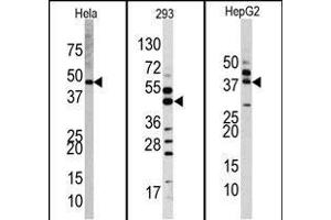Western blot analysis of anti-PK1 Antibody (Center) Pab (R) in Hela, 293, and HepG2 cell line lysates. (ERK2 anticorps  (AA 154-183))
