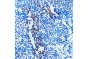 Immunohistochemistry of paraffin-embedded rat spleen using CASP3 antibody (ABIN4903140) at dilution of 1:100 (40x lens). (Caspase 3 anticorps)