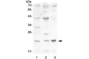 Western blot testing of 1) mouse small intestine, 2) mouse kidney and 3) mouse Neuro-2a lysate with Leptin antibody at 0. (Leptin anticorps  (AA 22-167))