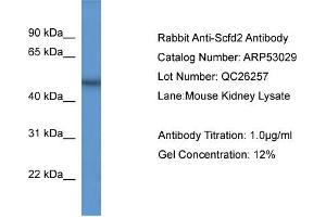 WB Suggested Anti-Scfd2  Antibody Titration: 0. (SCFD2 anticorps  (Middle Region))