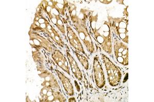 Immunohistochemistry of paraffin-embedded mouse intestin using TOPBP1 Rabbit pAb (ABIN6129493, ABIN6149398, ABIN6149401 and ABIN6221465) at dilution of 1:50 (40x lens). (TOPBP1 anticorps  (AA 1253-1522))