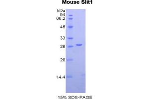 SDS-PAGE analysis of Mouse Slit Homolog 1 Protein. (SLIT1 Protéine)