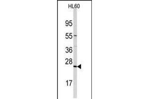 Western blot analysis of anti-TRAPPC4 Antibody in HL60 cell line lysates (35ug/lane) (TRAPPC4 anticorps  (N-Term))