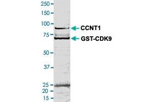 Image no. 1 for Cyclin-Dependent Kinase 9 (CDK9) (AA 1-372) (Active) protein (His tag) (ABIN5569637) (CDK9 Protein (AA 1-372) (His tag))