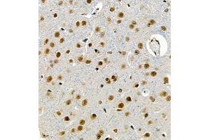 Immunohistochemistry of paraffin embedded rat brain using UBE3A (ABIN7076104) at dilution of 1:1000 (400x lens) (ube3a anticorps)
