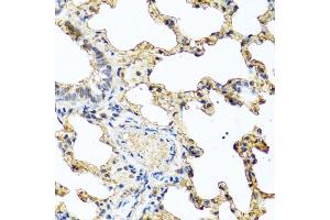 Immunohistochemistry of paraffin-embedded rat lung using PIP antibody (ABIN6131693, ABIN6145670, ABIN6145672 and ABIN6222022) at dilution of 1:100 (40x lens).