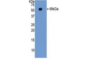 WB of Protein Standard: different control antibodies against Highly purified E. (Integrin beta 2 Kit ELISA)