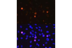 Immunofluorescence analysis of C6 cells using Phospho-Histone H3-S10 antibody (ABIN3019419, ABIN3019420, ABIN3019421, ABIN1681355 and ABIN7101861).