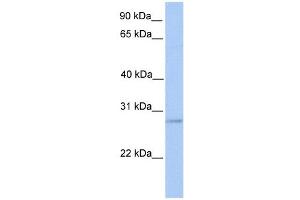 ORAI2 antibody used at 1 ug/ml to detect target protein. (ORAI2 anticorps  (Middle Region))