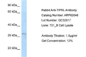 Western Blotting (WB) image for anti-TIP41-like protein (TIPRL) (N-Term) antibody (ABIN2788999) (TIPRL anticorps  (N-Term))