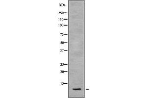 Western blot analysis SNAPC5 using HepG2 whole cell lysates