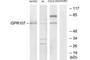 Western blot analysis of extracts from HuvEc/Jurkat/COLO205 cells, using GPR107 Antibody. (GPR107 anticorps  (AA 141-190))