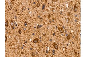 ABIN6259869 and ABIN6267009 at 1/100 staining Rat brain tissue by IHC-P. (AKT 1/2/3 anticorps  (C-Term, pan))