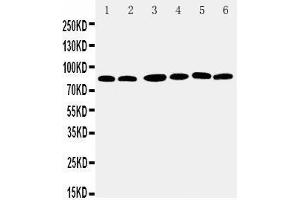 Anti-RSK1 p90 antibody, Western blotting Lane 1: MCF-7 Cell Lysate Lane 2: HELA Cell Lysate Lane 3: K562 Cell Lysate Lane 4: JURKAT Cell Lysate Lane 5: SW620 Cell Lysate Lane 6: RAJI Cell Lysate
