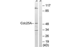 Western blot analysis of extracts from Jurkat cells, using CDC25A (Ab-178) Antibody. (CDC25A anticorps  (AA 144-193))