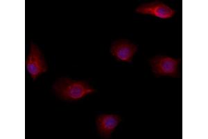 ABIN6264573 and ABIN6278624 staining Hela by IF/ICC. (RAB35 anticorps  (Internal Region))