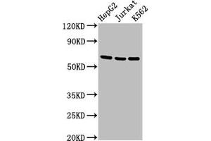 Western Blot Positive WB detected in: HepG2 whole cell lysate, Jurkat whole cell lysate, K562 whole cell lysate All lanes: TNFRSF9 antibody at 2. (CD137 anticorps  (AA 24-186))