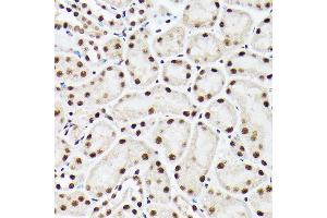 Immunohistochemistry of paraffin-embedded mouse kidney using A Rabbit pAb (ABIN6129868, ABIN6136479, ABIN6136480 and ABIN6221034) at dilution of 1:100 (40x lens). (BAF53A anticorps  (AA 1-280))
