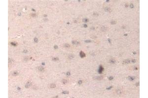 Detection of HPS4 in Mouse Cerebrum Tissue using Polyclonal Antibody to Hermansky Pudlak Syndrome Protein 4 (HPS4)