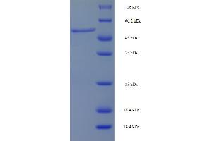 SDS-PAGE (SDS) image for Mitogen-Activated Protein Kinase Kinase 6 (MAP2K6) (AA 1-334), (full length) protein (His-SUMO Tag) (ABIN5709901)