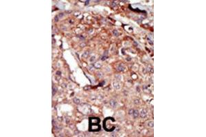 Immunohistochemistry (IHC) image for anti-Bromodomain Containing 2 (BRD2) antibody (ABIN3003651) (BRD2 anticorps)