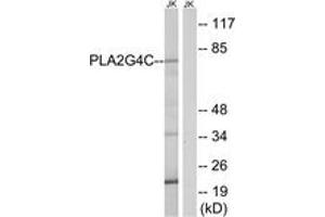 Western blot analysis of extracts from Jurkat cells, using PLA2G4C Antibody.