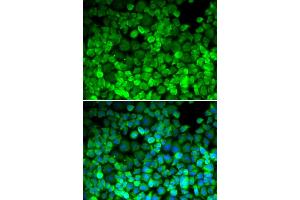 Immunofluorescence analysis of HeLa cells using TERF1 antibody.
