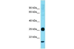 Western Blotting (WB) image for anti-RAB31, Member RAS Oncogene Family (RAB31) (Middle Region) antibody (ABIN2788973) (RAB31 anticorps  (Middle Region))