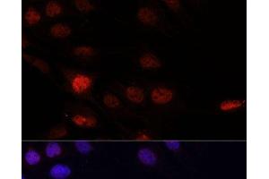 Immunofluorescence analysis of C6 cells using KLHL8 Polyclonal Antibody at dilution of 1:100. (KLHL8 anticorps)