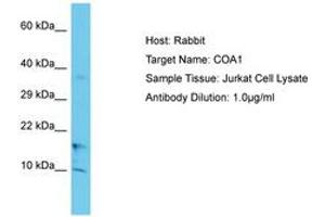 Image no. 1 for anti-UBX Domain Protein 11 (UBXN11) (C-Term) antibody (ABIN6750641) (UBXN11 anticorps  (C-Term))