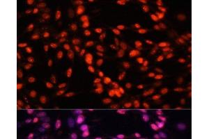 Immunofluorescence analysis of NIH-3T3 cells using MCM5 Polyclonal Antibody at dilution of 1:100.