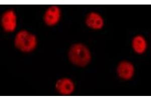 ABIN6277385 staining Hela cells by IF/ICC. (HOXC8 anticorps  (Internal Region))