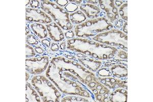 Immunohistochemistry of paraffin-embedded Rat kidney using Alpha-tubulin (ubiquitous) chain antibody (ABIN7271033) at dilution of 1:50 (40x lens). (TUBA1B anticorps  (AA 1-451))