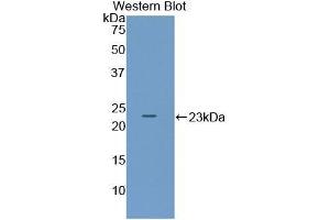 Detection of Recombinant ADCYAP1, Mouse using Polyclonal Antibody to Pituitary Adenylate Cyclase Activating Peptide (PACAP) (Pituitary Adenylate Cyclase Activating Peptide (AA 1-175) anticorps)