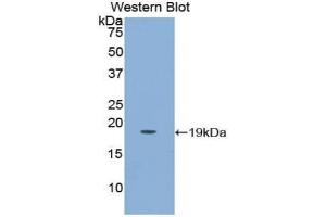 Western blot analysis of the recombinant protein. (PLGF anticorps  (AA 43-162))