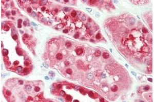 Human Kidney: Formalin-Fixed, Paraffin-Embedded (FFPE)