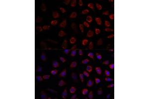Immunofluorescence analysis of L929 cells using PDE11A antibody (ABIN7269298) at dilution of 1:100.