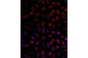 Immunofluorescence analysis of L929 cells using PDE11A antibody (ABIN7269298) at dilution of 1:100. (PDE11A anticorps  (AA 712-933))