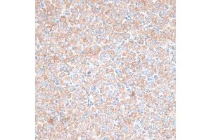 Immunohistochemistry of paraffin-embedded rat ovary using PMEP antibody (6555) at dilution of 1:100 (40x lens). (PMEPA1 anticorps  (AA 173-252))
