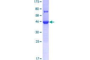 Image no. 1 for Coiled-Coil Domain Containing 117 (CCDC117) (AA 1-170) protein (GST tag) (ABIN1348255)
