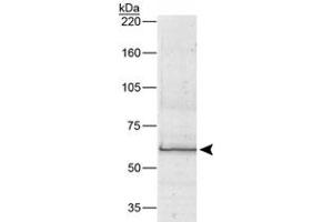 Western blot analysis of BEST1 (68 kDa) from human RPE cell lysate using BEST1 monoclonal antibody, clone E6-6  (1 : 1000). (Bestrophin 1 anticorps)